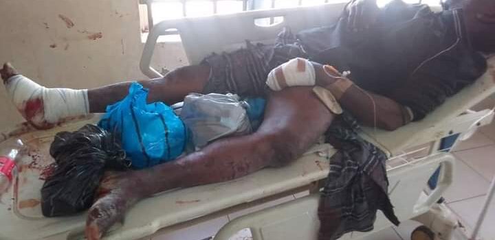 APC warns Saraki against reintroduction of thuggery to Kwara politics